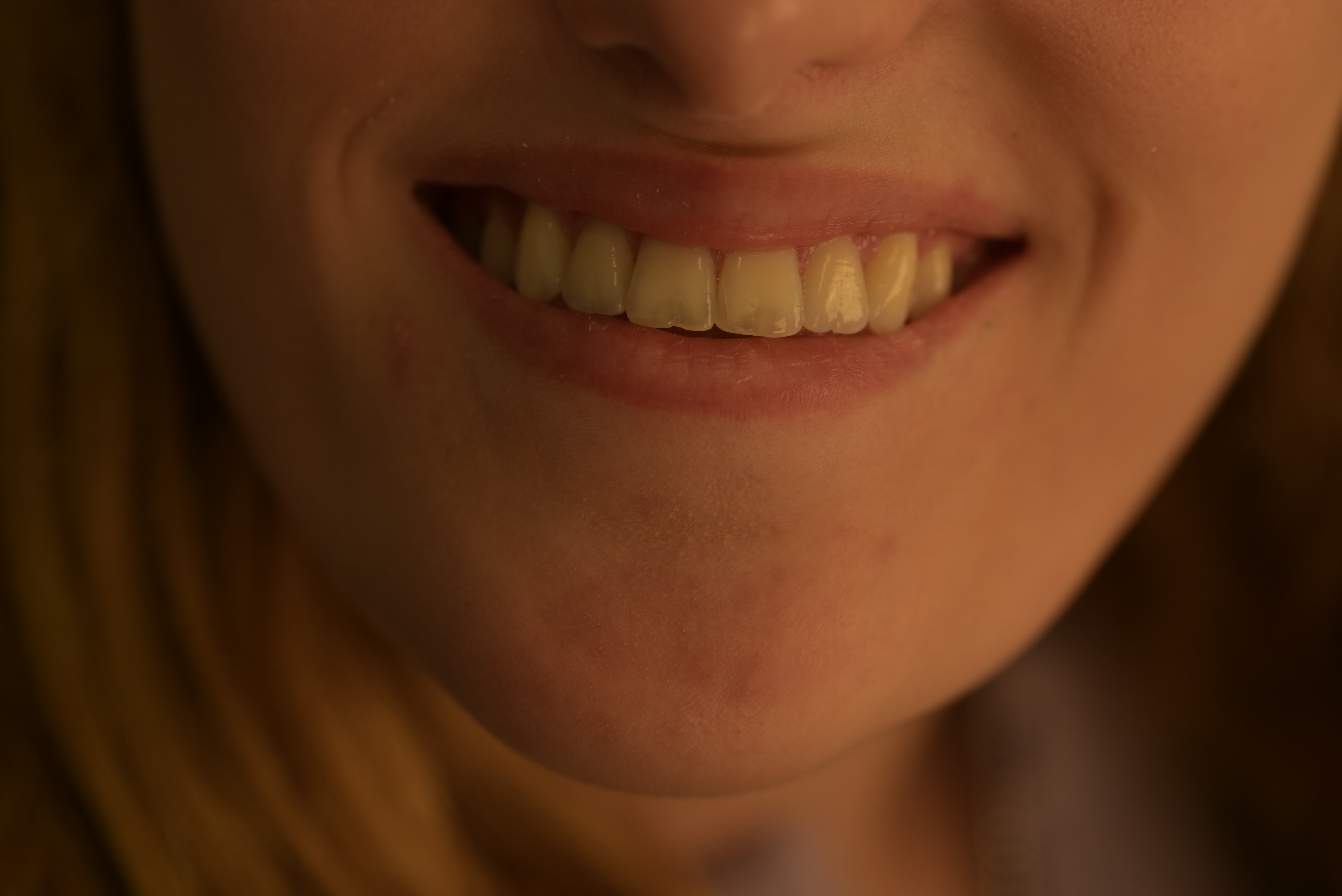 white spots removal